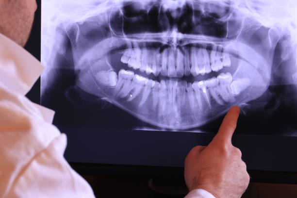 Best Emergency Dentist for Knocked-Out Tooth in Saxonburg, PA